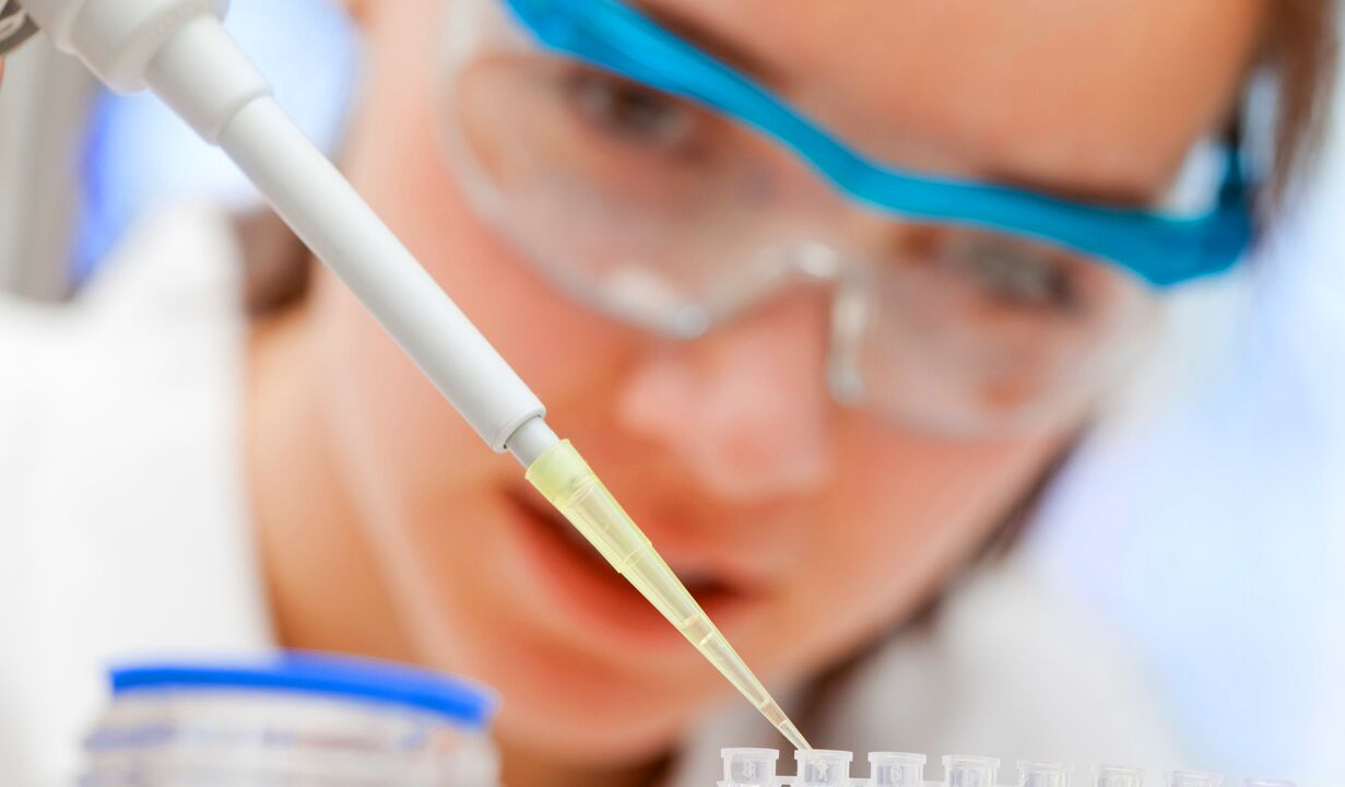 Uriini laboratoorne analüüs - meetod prostatiidi diagnoosimiseks