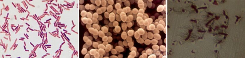 Kroonilise bakteriaalse prostatiidi peamised põhjustajad on E. coli, fekaalne enterokokk ja proteus